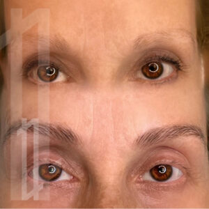 antes y después de una micropigmentación de cejas para mujeres en Bilbao