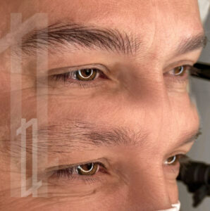 micropigmentación de hombres en Bilbao