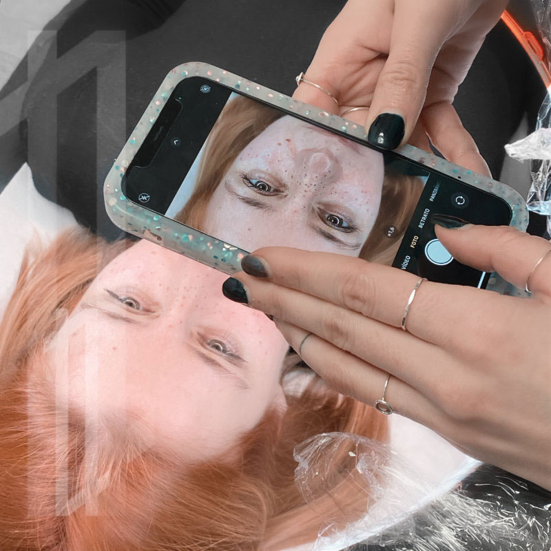 micropigmentación de marcas de belleza en la cara en Bilbao